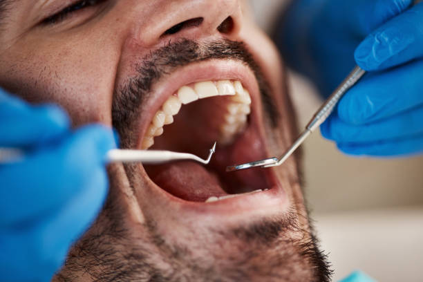 Best Broken or Cracked Tooth Emergency Dentist in USA